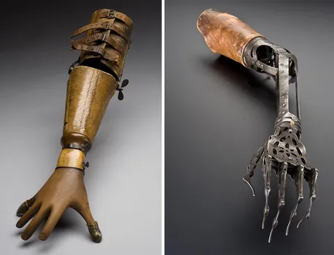 Victorian era prostetic arms: Left is a special arm designed for a pianist (notice the position of the fingers) and right an more complex and ornate metal hand. Source in comment.