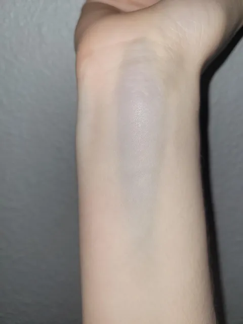 My xl wrist vein