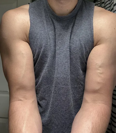 One of my arms has a straight vein and one has a squiggly vein 
