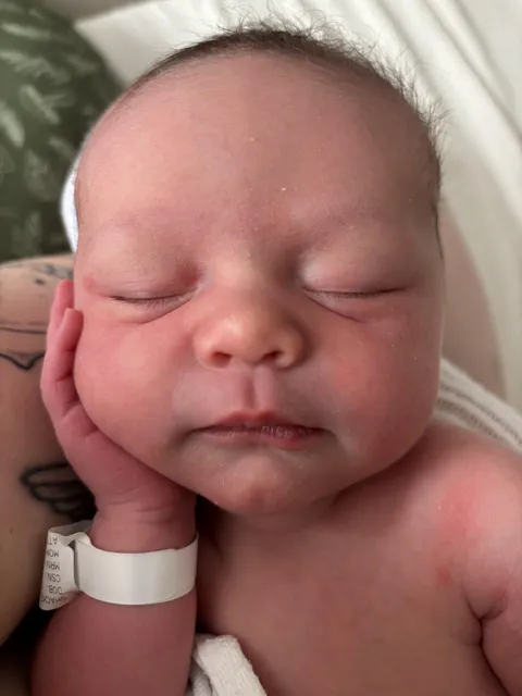 Successful IVF &amp; she got my chin