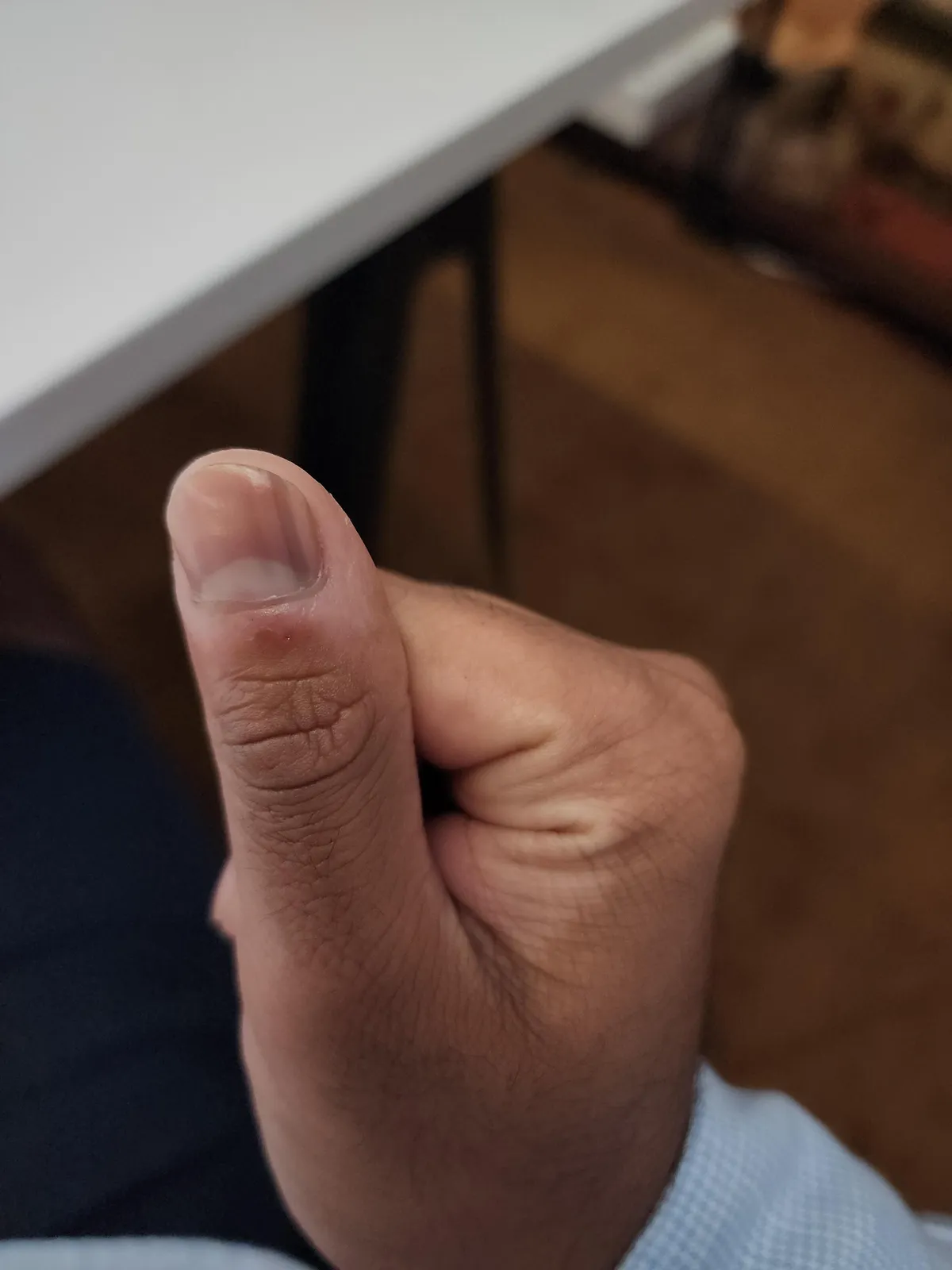 My fingernail has a dark blue line on it