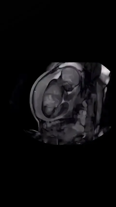 Reason why babies love gentle patting for sleep