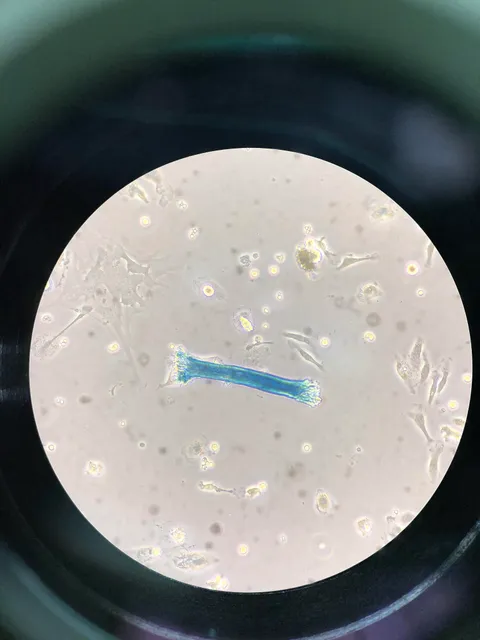 Unknown substance in cell culture