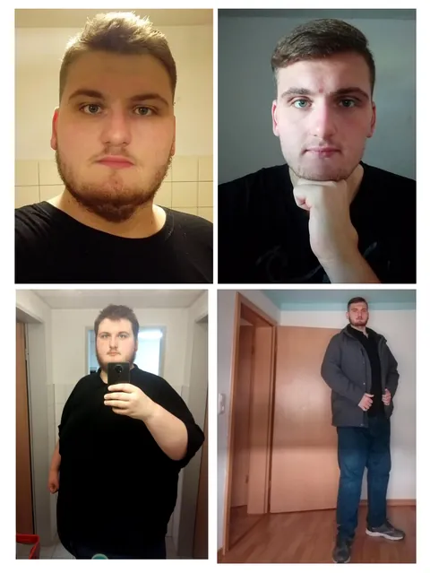 I lost 300Lbs and beat Obesity :D