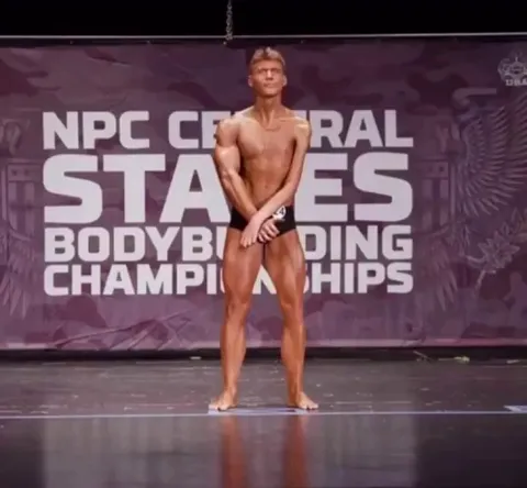 Bodybuilder Jackson Schop competing even though he has a paralyzed arm