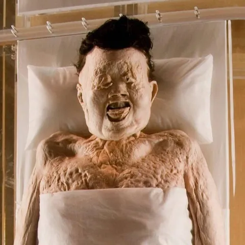 Xin Zhui - better known as Lady Dai - is considered one of the best-preserved mummies in history. Though she died over 2,200 years ago, her skin is still soft to the touch, her hair and eyelashes are intact, and there was still blood in her veins when she was discovered in 1971.