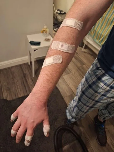 Shower screen fell off and sliced me to ribbons. Dude who tried to replace it ripped the tiles off