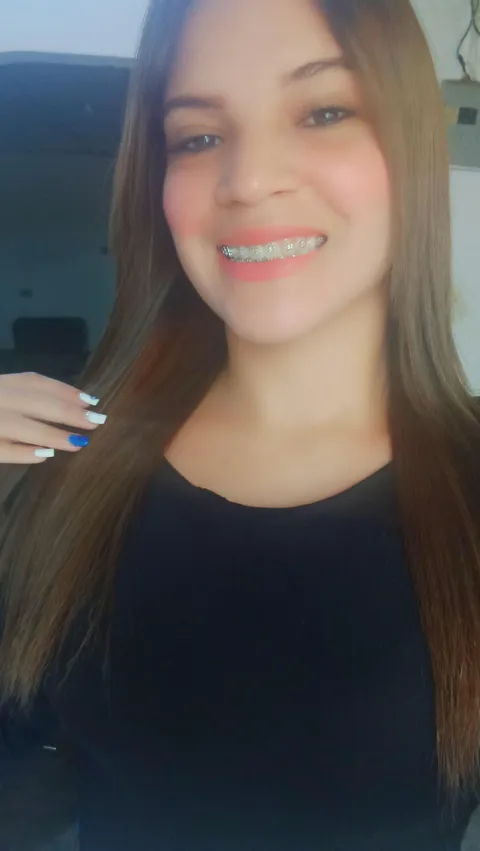 I love my braces, but I have to take them off 😭😭