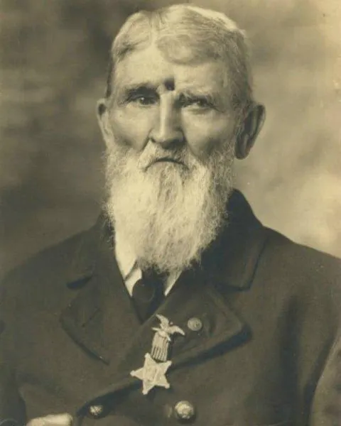 American civil war soldier Jacob Miller was shot through the head and left for dead by his fellow soldiers. He walked around with not only a visible bullet hole, but a bullet in his head for 31 years.