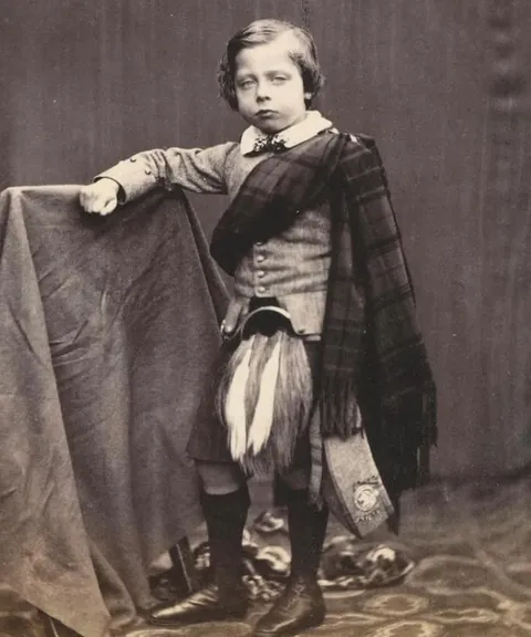 Queen Victoria described her 8th child Prince Leopold, as "the ugliest and least pleasing of the whole family". She frequently depicted him as grotesque in drawings and criticized his appearance. Out of all of her children, he arguably looked the most like her.