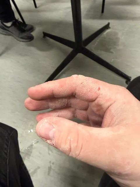 Dry Air + Constantly working with cardboard boxes