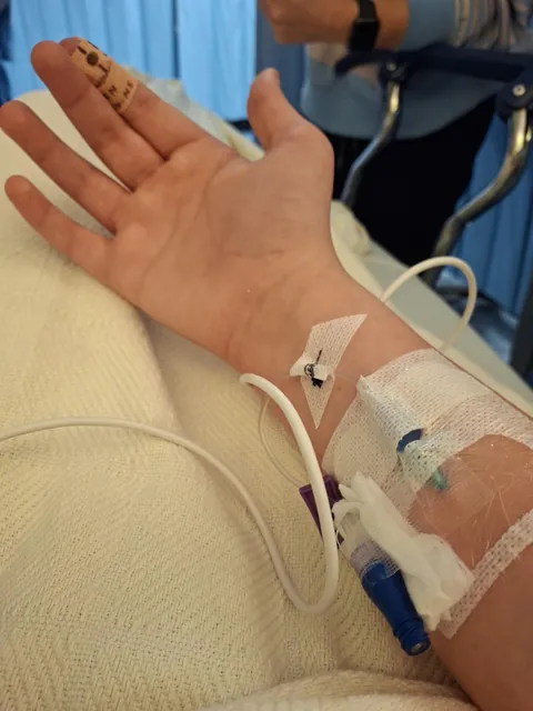 I had testicular torsion and had to get surgery