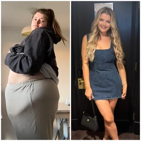 Insane weight loss transformation 