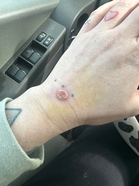 Four different doctors, a myriad of prescriptions, nonstop pain and nobody can figure out what this is.