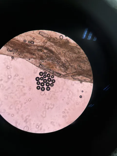 Strange circular pattern under the microscope – not sure what I’m seeing