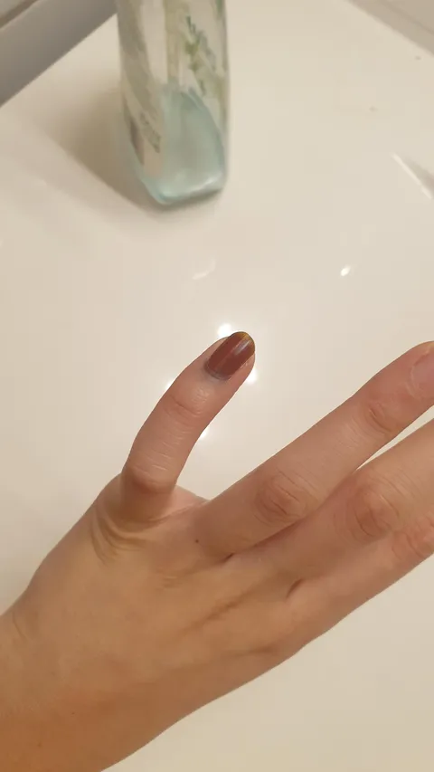 My nail grows out in a different colour