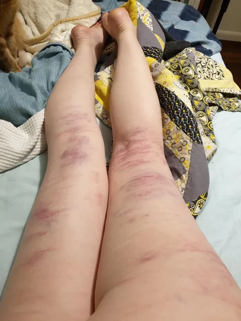 from my latest beating