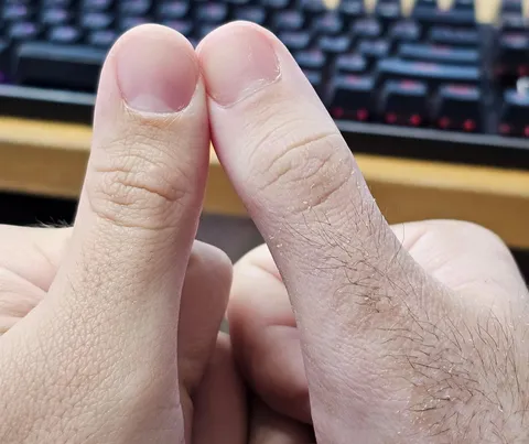 My right thumb which was under a cast for a month has become much hairier than my left.