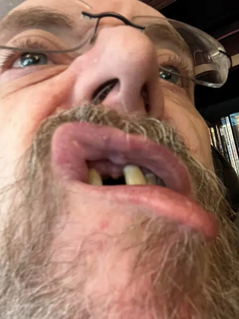 Long time roaster, first time poster. You turds can’t hurt me.