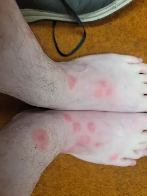 My family says I have 'sugar blood'