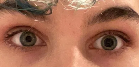 My pupils are almost never the same size