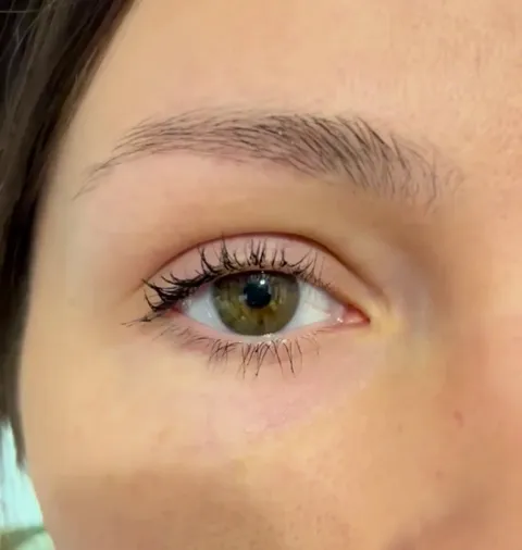 My lower eyelid has not stopped twitching for two hours straight now!!