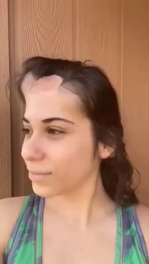 This woman has a cancer survivor and shows progression before and after 