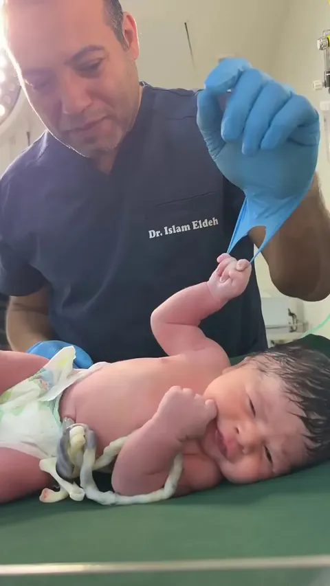 Testing of a newborn baby strong palmar grasping reflex.