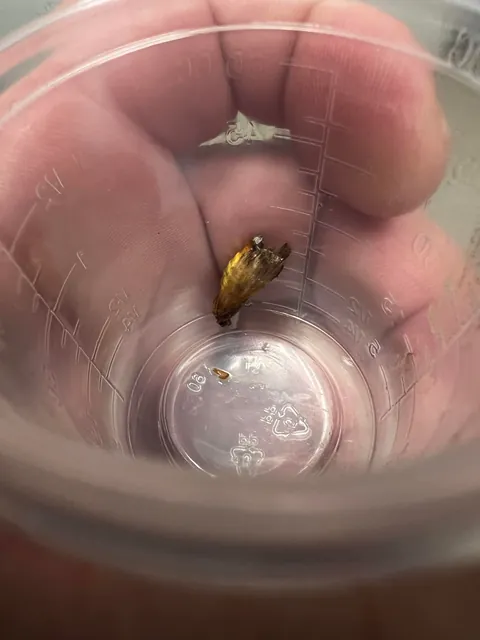A moth flew into my ear and had to go to the ER