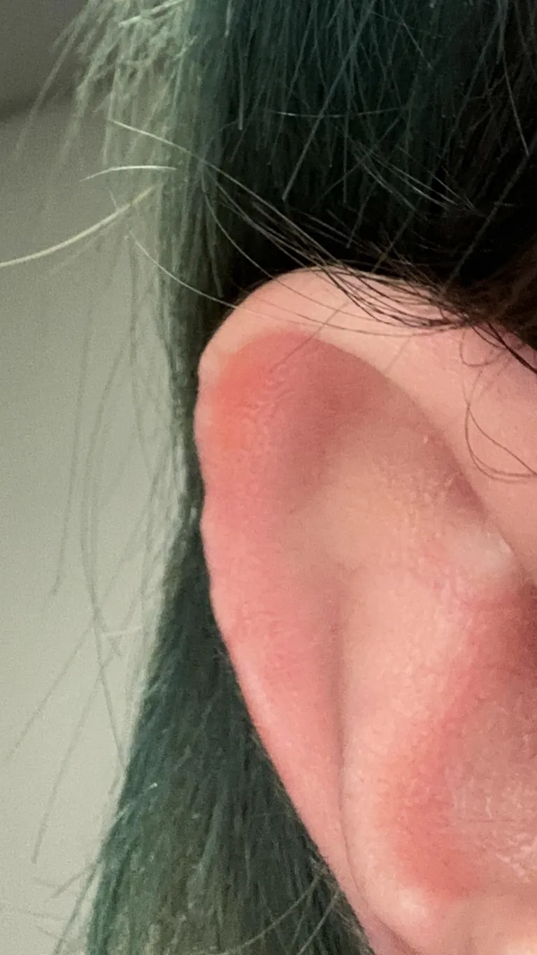 I Just realized that my ears are jagged around the edges