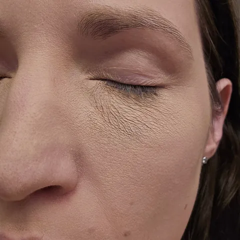 Help me cover my black eye for my job interview, please!