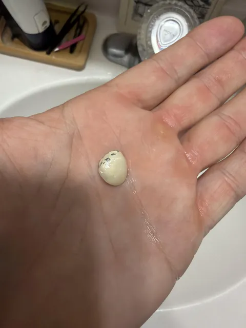 Crown fell out one month before insurance kicks in