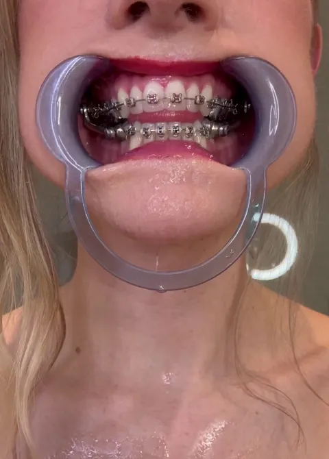 My last ortho appointment got a little out of hand