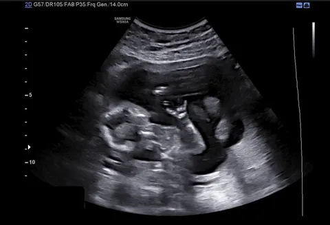 We’re having a surfer baby [OC]