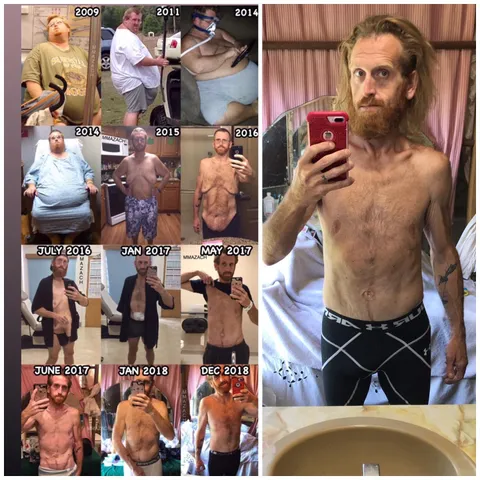 Me before and after losing weight.