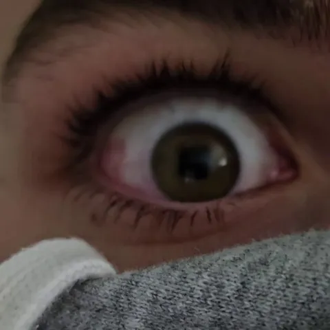 I can perform voluntary cyclotorsion (rotating my eyes at will)