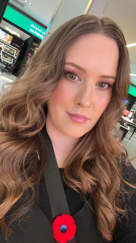 Took a year but I fixed my skin