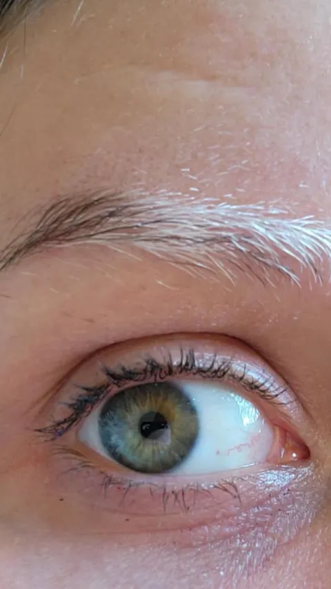 One of my eyebrows has been turning white. No other hair is doing this.