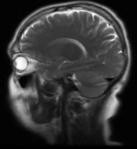 So I had an MRI last week and, kinda scary.