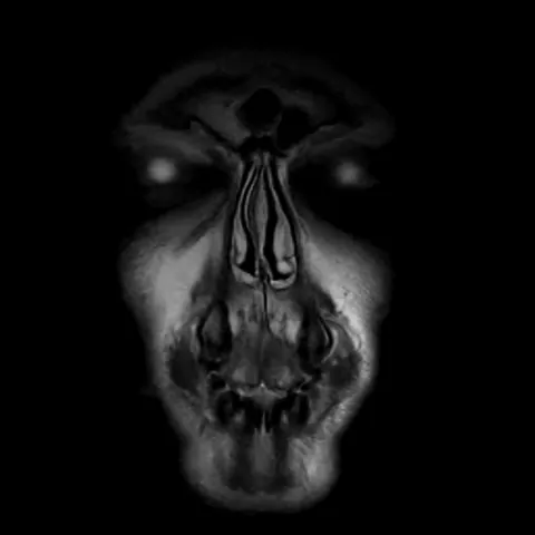 So I had an MRI last week and, kinda scary.