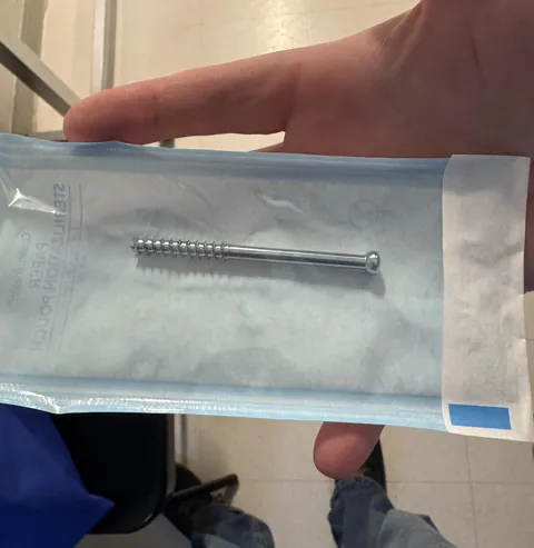 Screw that was previously holding elbow together