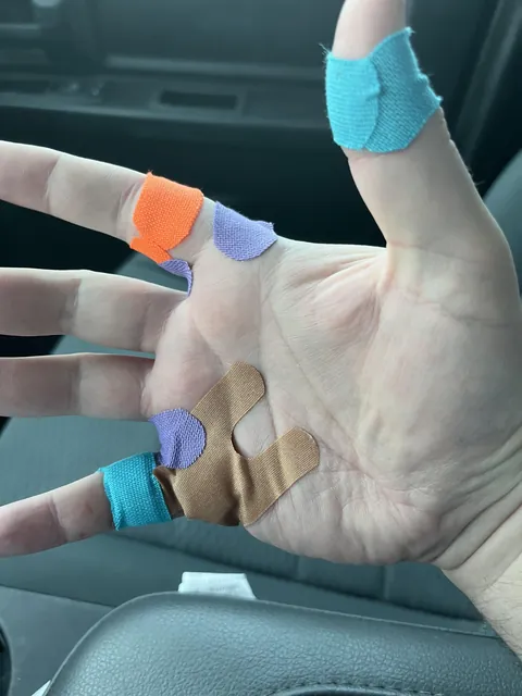 Mom’s cat mauled my hand