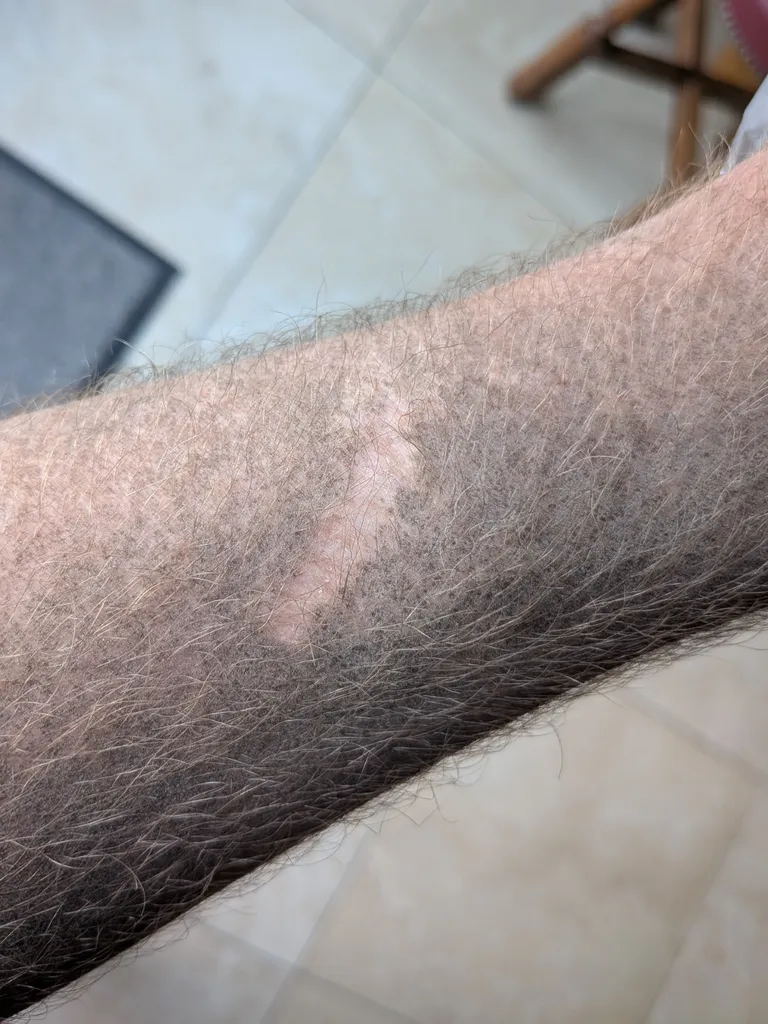 My old scar is dust repellent.