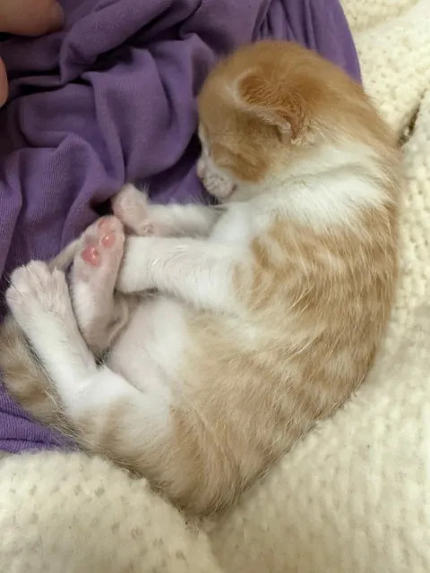 Born with no EyeBalls (anophthalmia)... My Beauty Queen