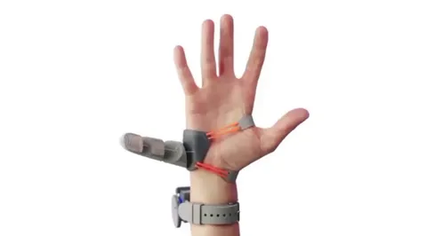 Researchers from the University of Cambridge have developed the Third Thumb, a robotic prosthetic that significantly enhances hand functionality