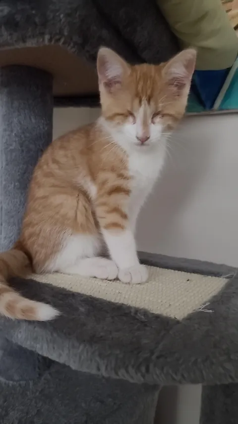 Born with no EyeBalls (anophthalmia)... My Beauty Queen