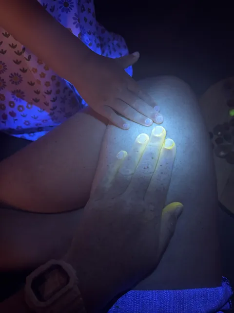 The way my fingers glow in UV light (I’m a beekeeper)