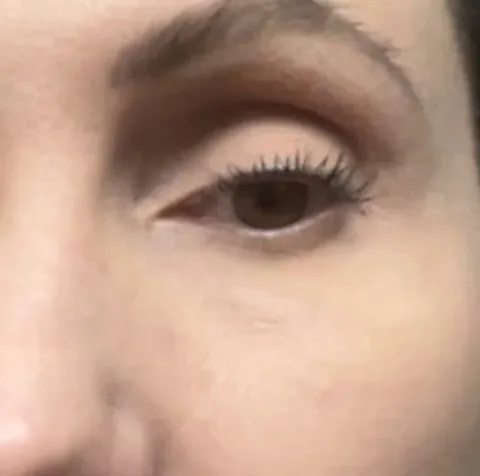 My eyelid has been twitching like this 24/7 for 5 weeks.