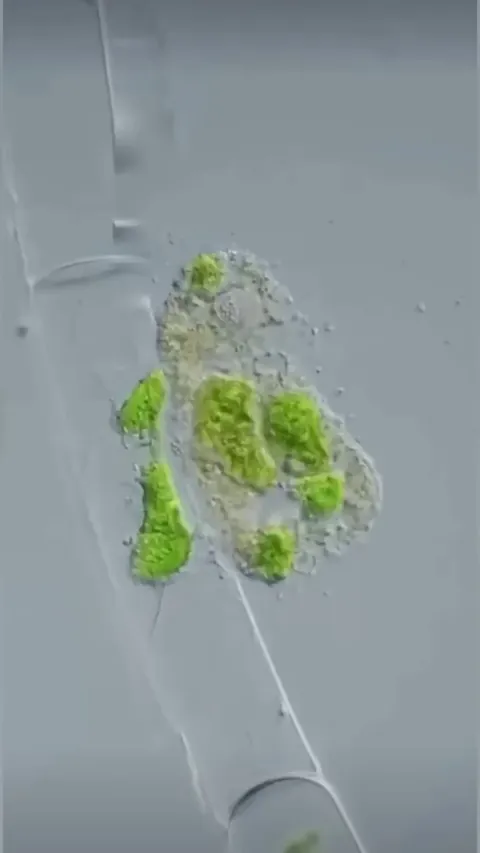 🔥 Amoeba devouring plant cells one by one
