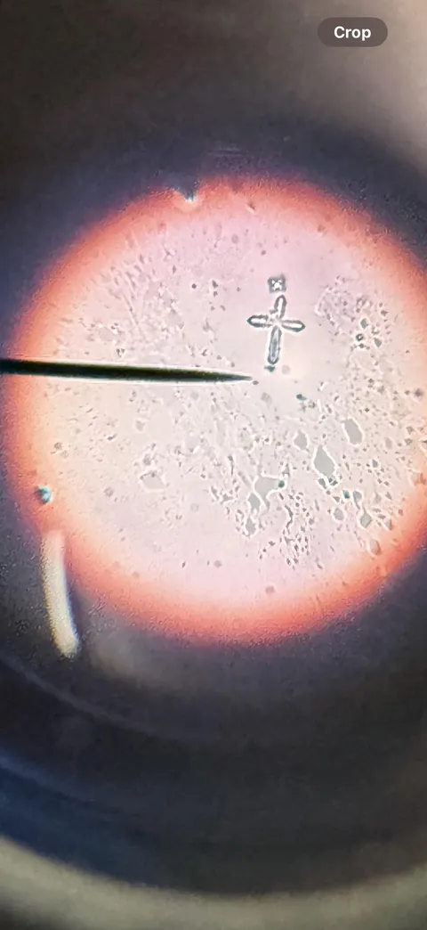 Found this in a sample of cheek tissue